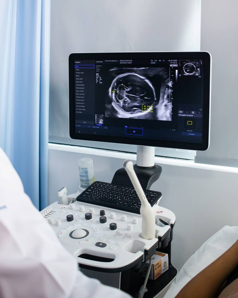 Ultrassonografia obstétrica em prática