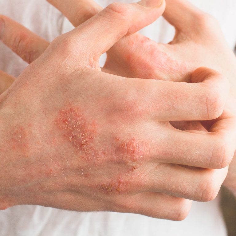 Dermatologia Pediátrica