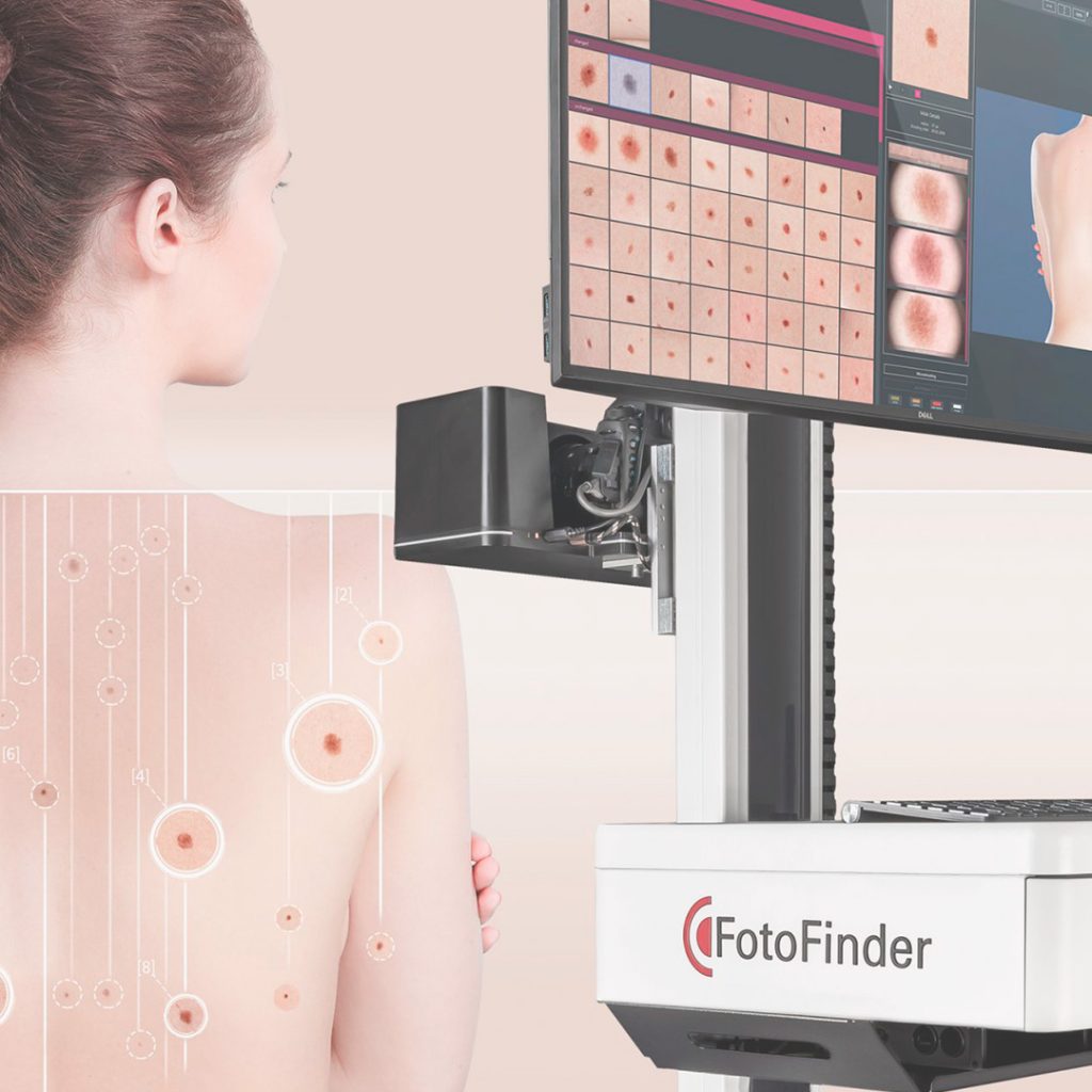 FotoFinder® (mapeamento corporal digital)