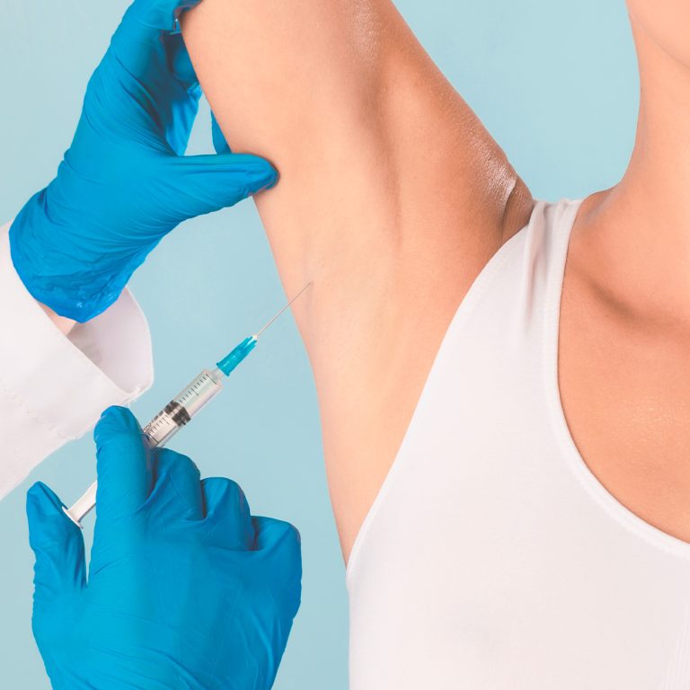 Hiperidrose (suor excessivo)