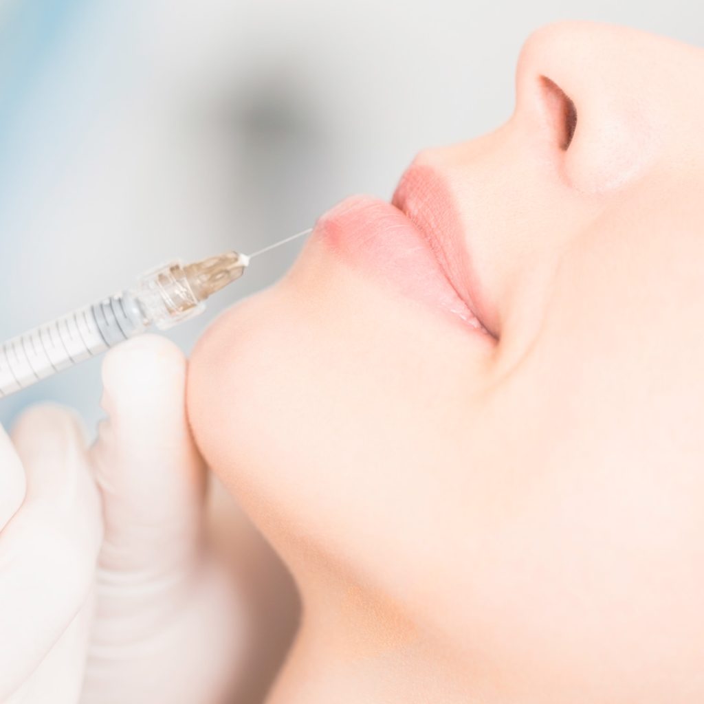Preenchimento com ácido hialurônico