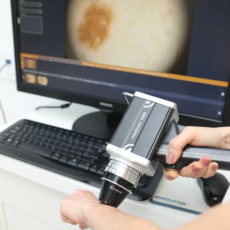 Cirurgia de c&acirc;ncer de pele