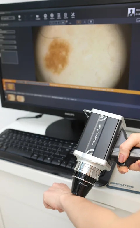 Fotofinder