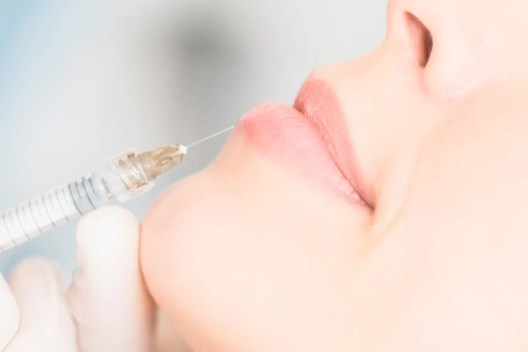 LipSculpt